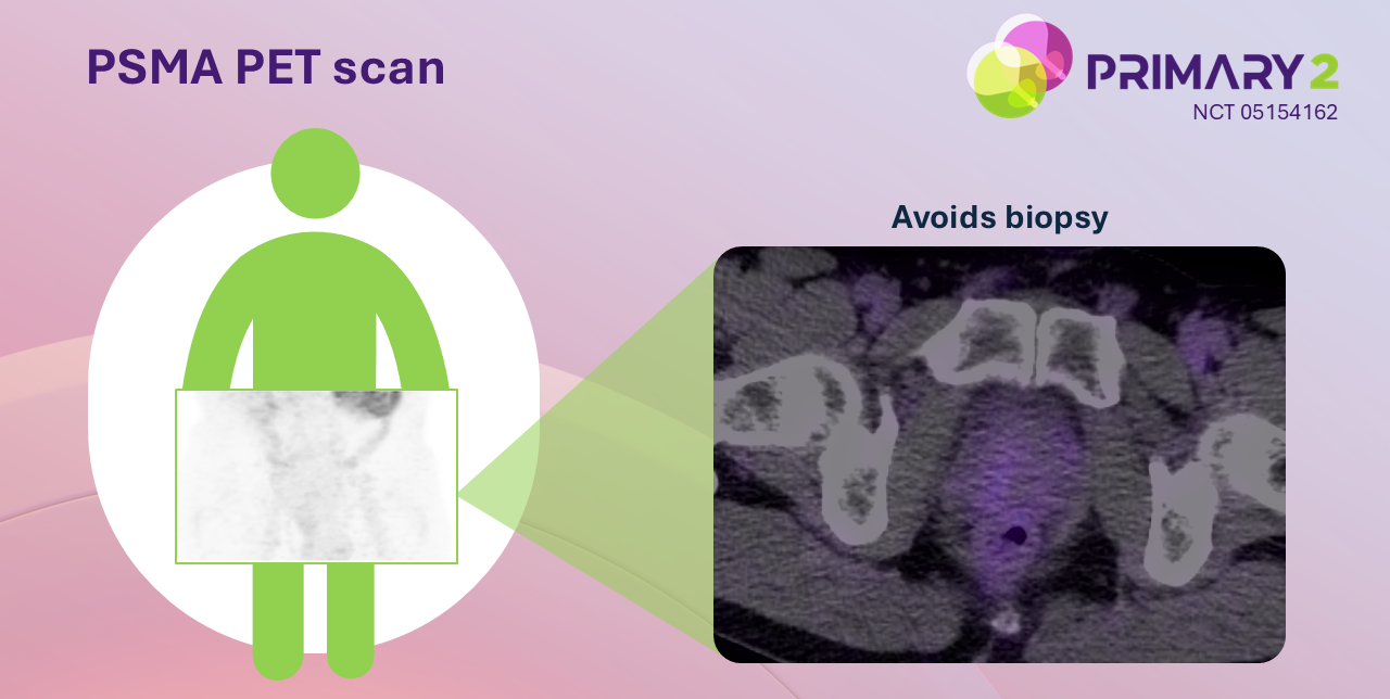 PSMA PET Scan Slide1